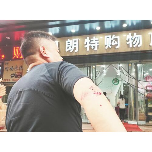 淄博男子逛超市电梯上摔倒受伤 奥朗特购物广场称会彻查